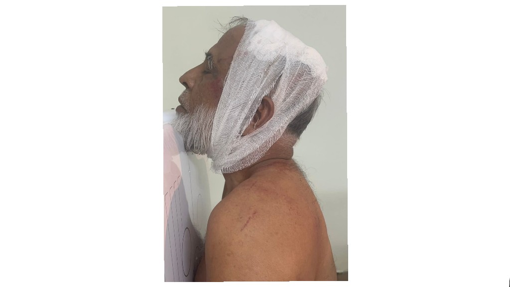 বিএনপি নেতা আহাম্মদ চেয়ারম্যানের ওপর নৃশংস হামলা