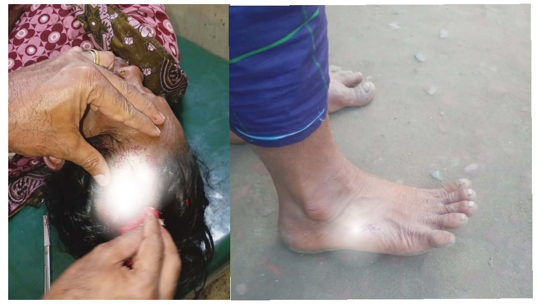 চালিভাঙ্গা ইউনিয়নের মৈশারচর গ্রামে হামলার ঘটনা: নারীসহ একাধিক আহত, এলাকায় আতঙ্ক!