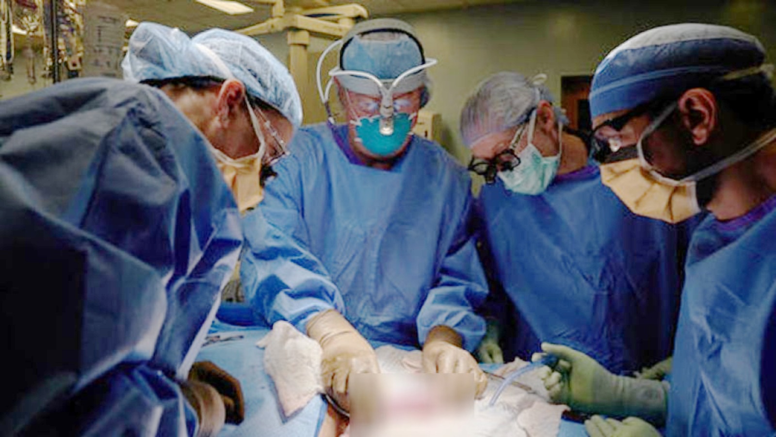 নতুন জীবনের আলো: বিএমইউতে সফল কিডনি প্রতিস্থাপন, মায়ের দানে বাঁচল সন্তানের প্রাণ